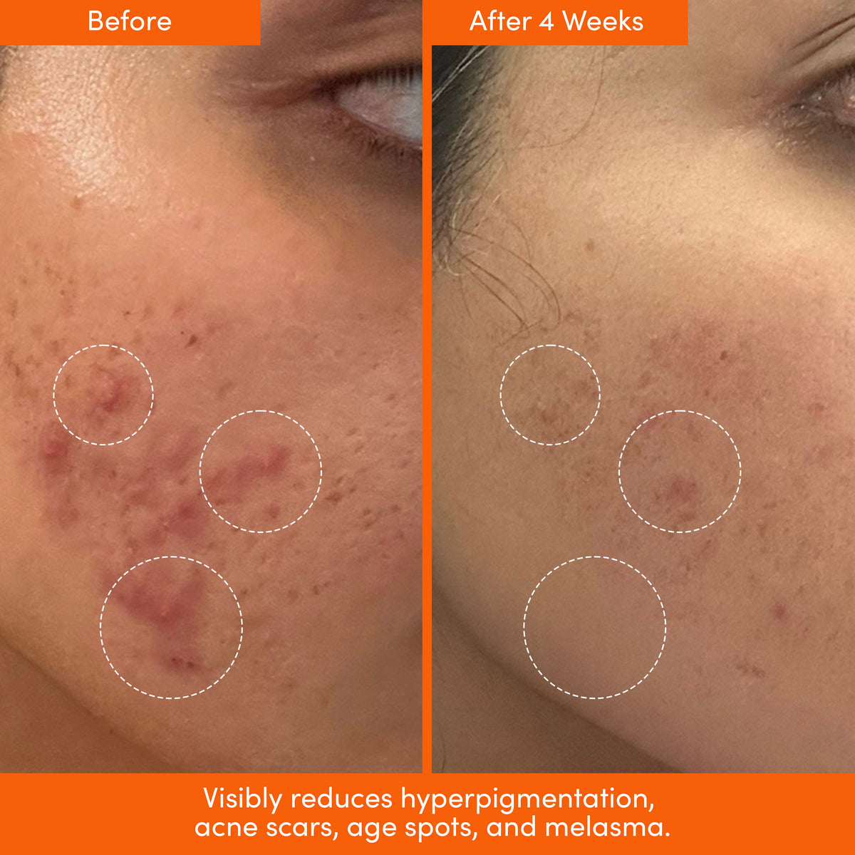 THE PLACENTA FACIAL Dark Spot Serum + Barrier Repair Cream Bundle — image 6