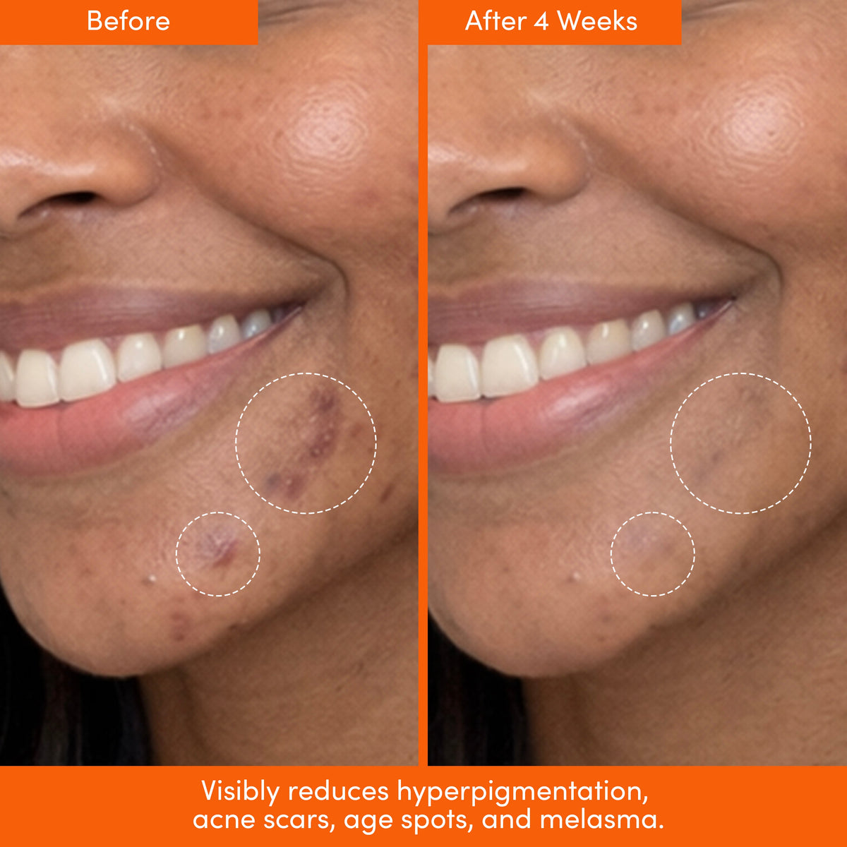 THE PLACENTA FACIAL Dark Spot Serum + Barrier Repair Cream Bundle — image 8