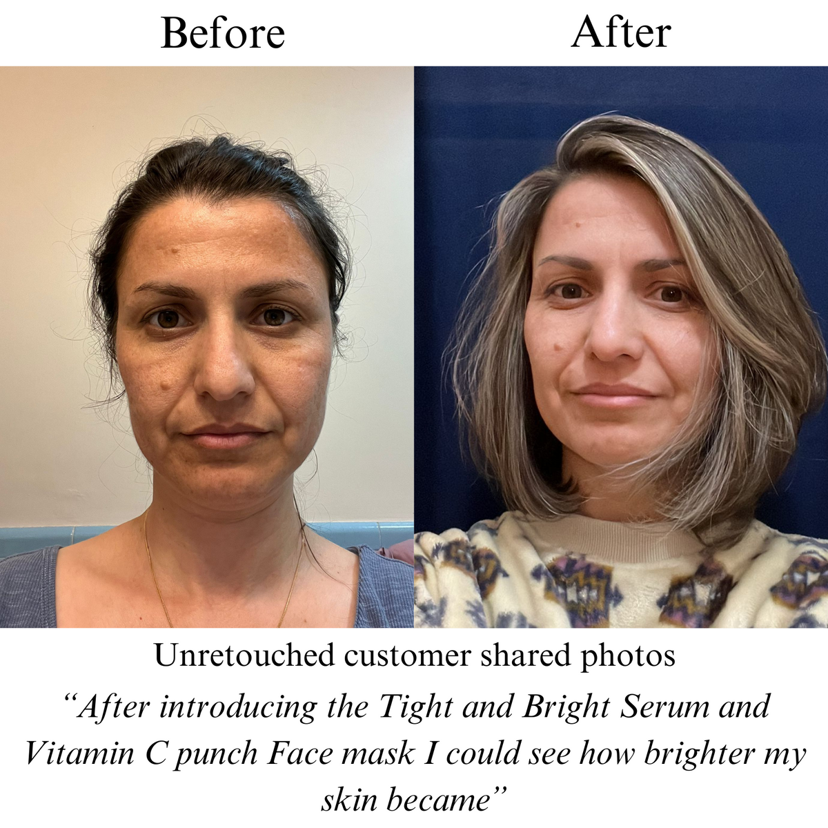 TIGHT AND BRIGHT, an Advanced Gentle Phyto-Retinol and Vitamin C Face Serum, 12 Innovative Technologies, 55% High-Performance Cosmeceuticals — image 7