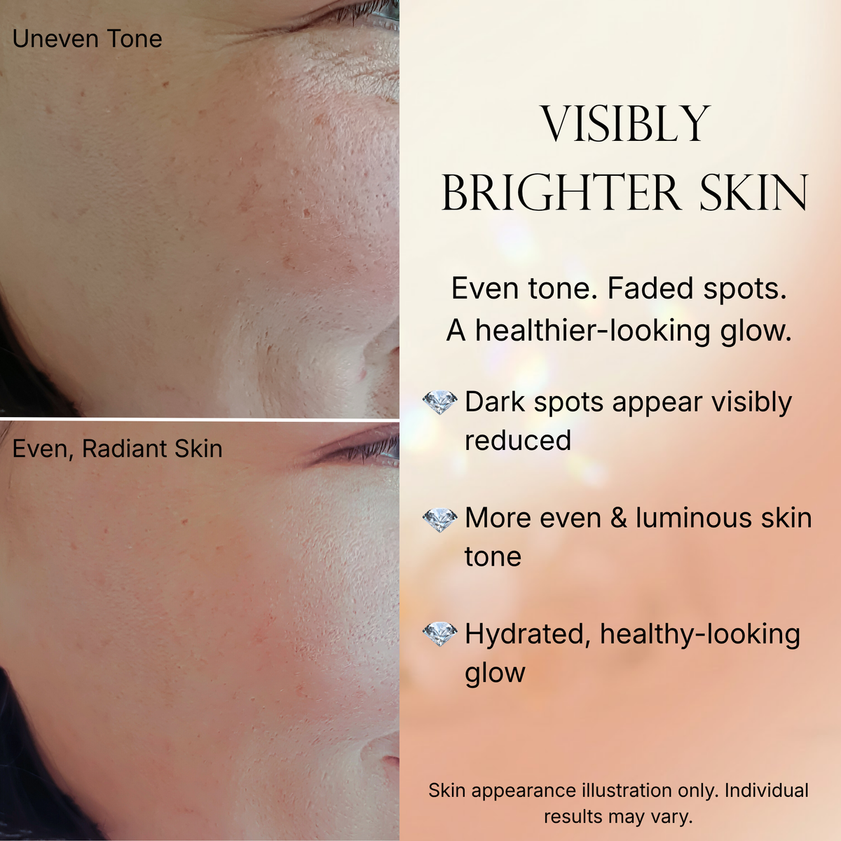 Caramela Beauty Even Tone Serum for Brightening Dark Spots & Hyperpigmentation with Kojic Acid, Hyaluronic Acid & Centella Asiatica