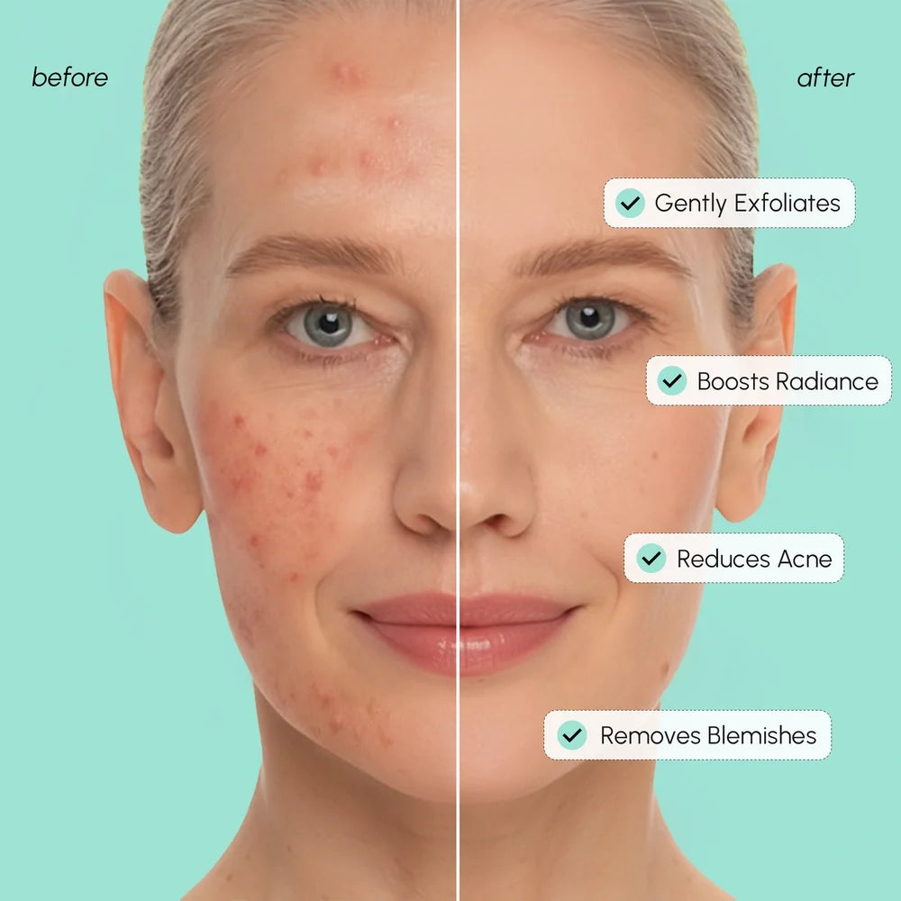 Azelaic Acid Soothing Pads — image 4