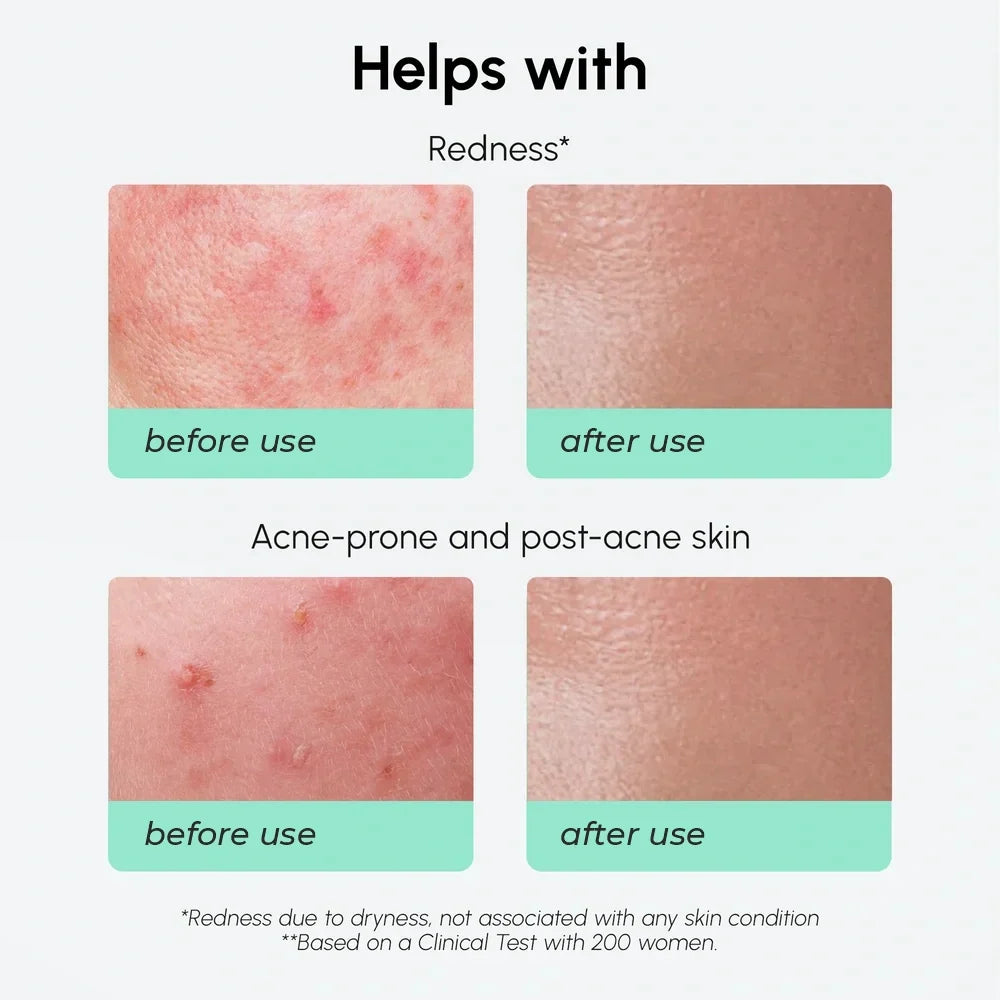 Redness Soothing Azelaic Acid Serum — image 5