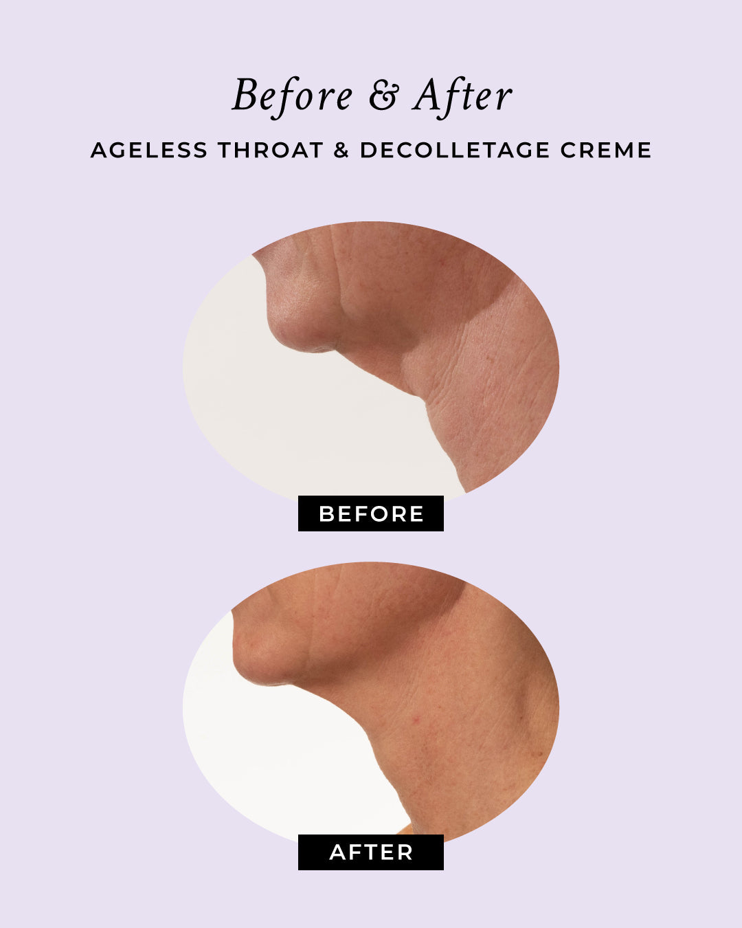 Ageless Throat & Decolletage Anti-Aging Neck Creme by PRAI Beauty — image 5 of 10