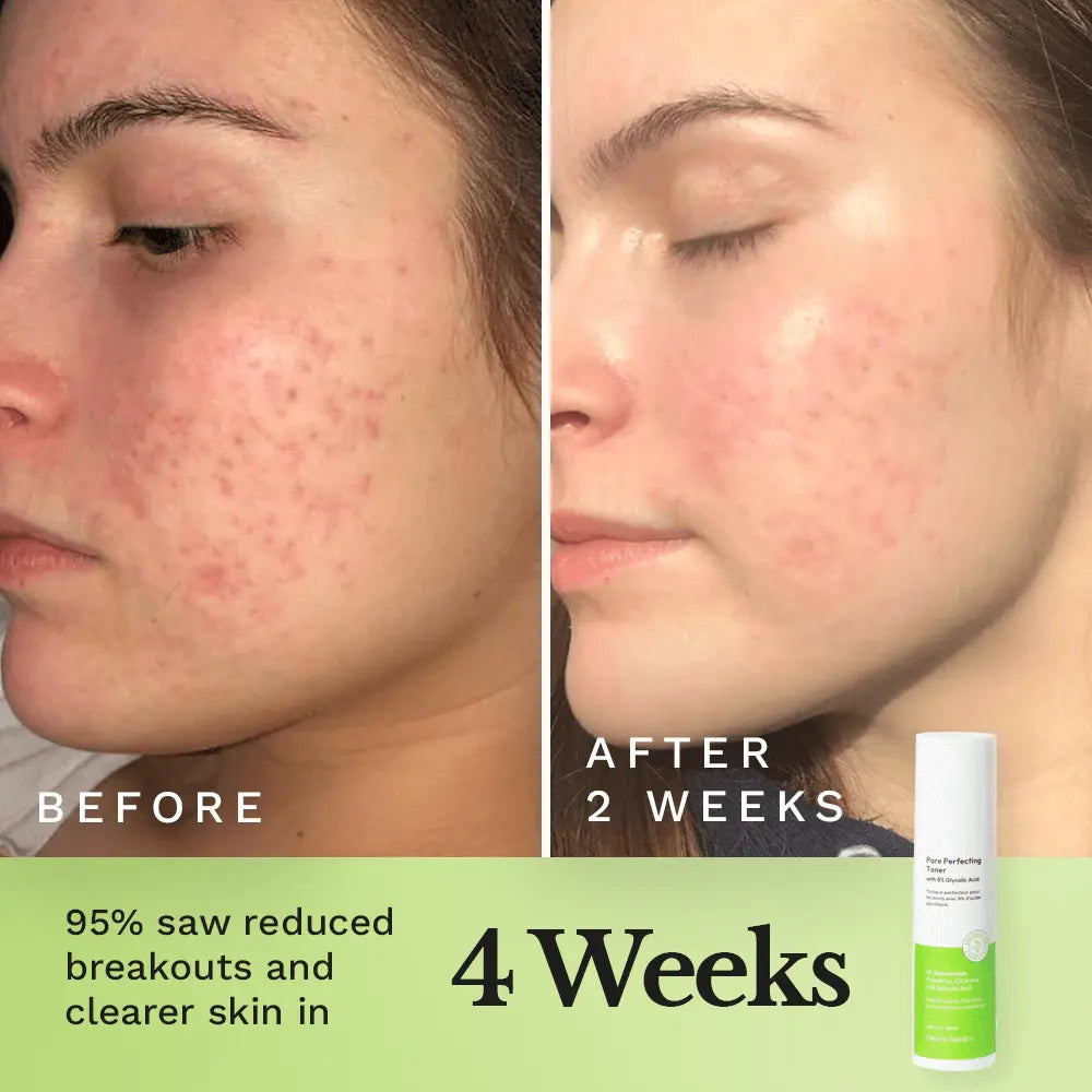 Pore Perfecting Toner — image 3