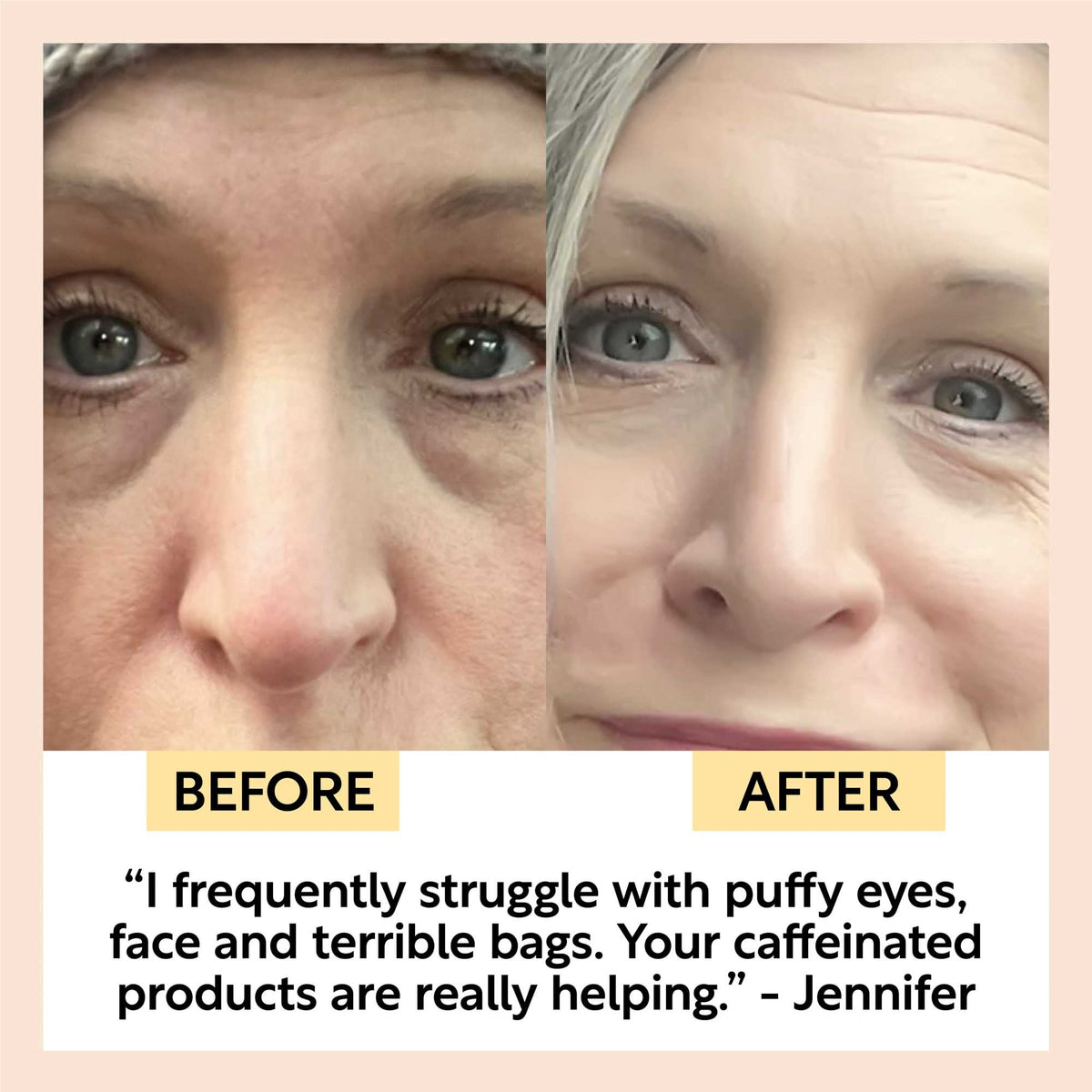 Day + Night Eye Care Bundle — image 6