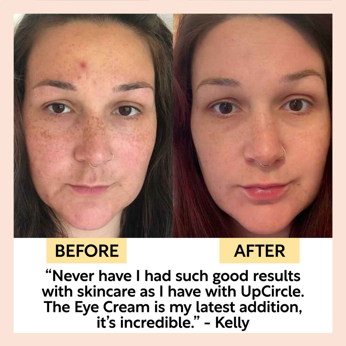 Eye Cream with Hyaluronic Acid & Coffee — image 9