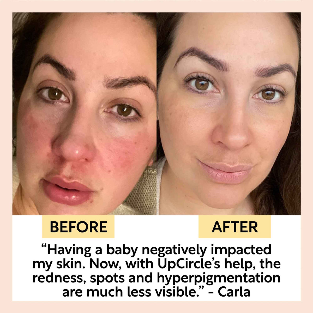 Day + Night Hydration Set — image 9