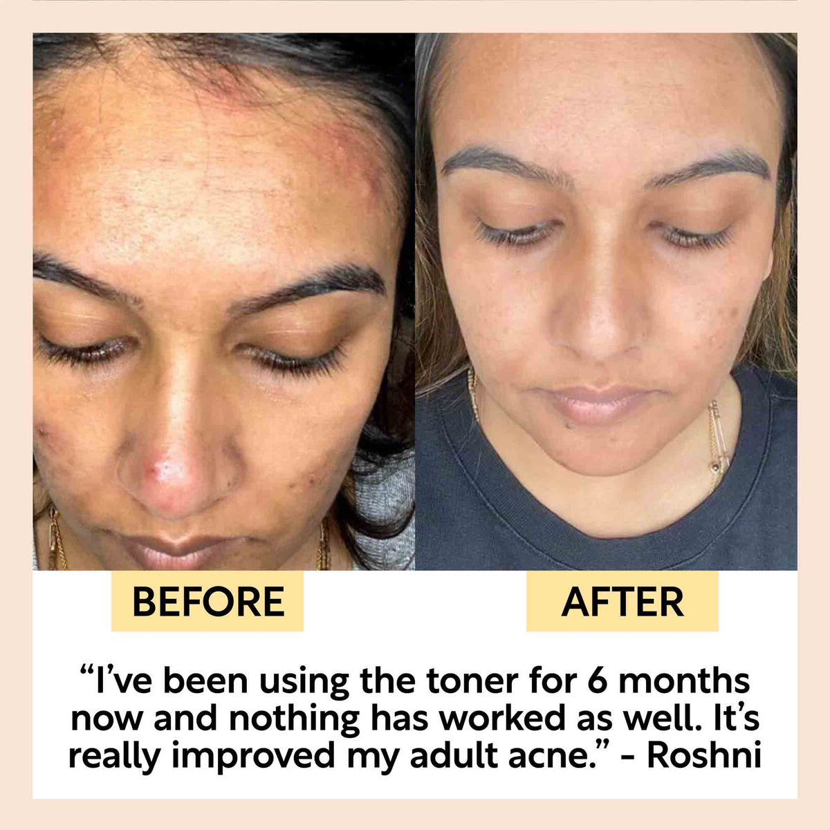 Face Toner with Hyaluronic Acid - Travel Size — image 10