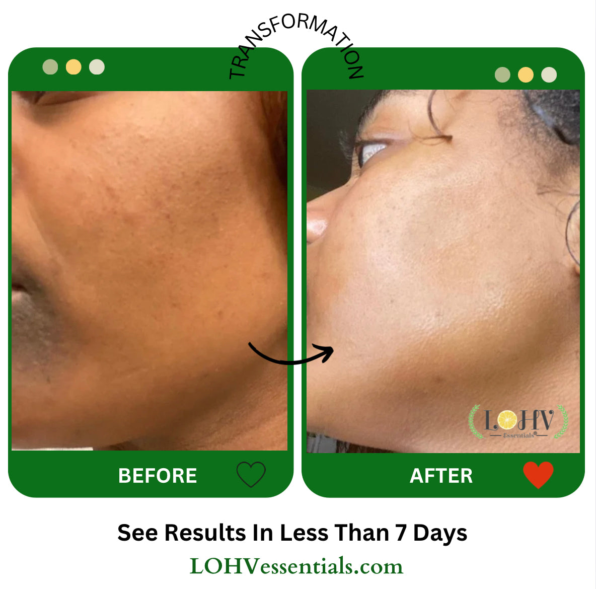 PREMIUM 100% VEGAN GLOW UP Toner Serum With Hyaluronic Acid + Niacinamide + Camellia Leaf + Vitamin E + Rose Water — image 6