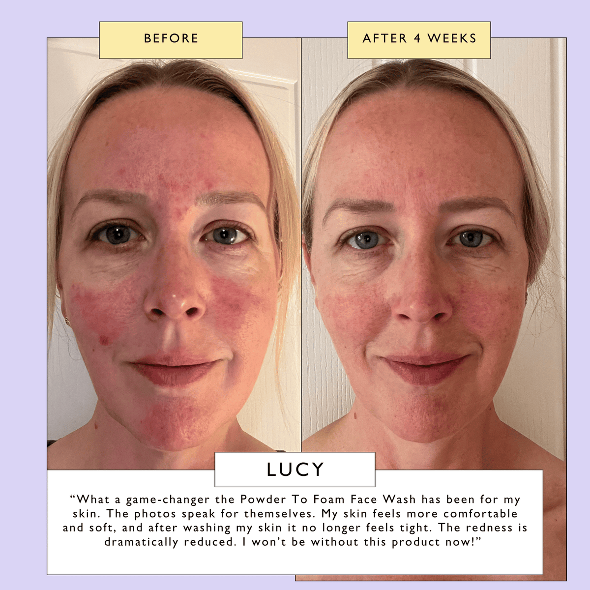 Powder To Foam Face Wash with Willow Bark + Papaya Enzymes — image 5