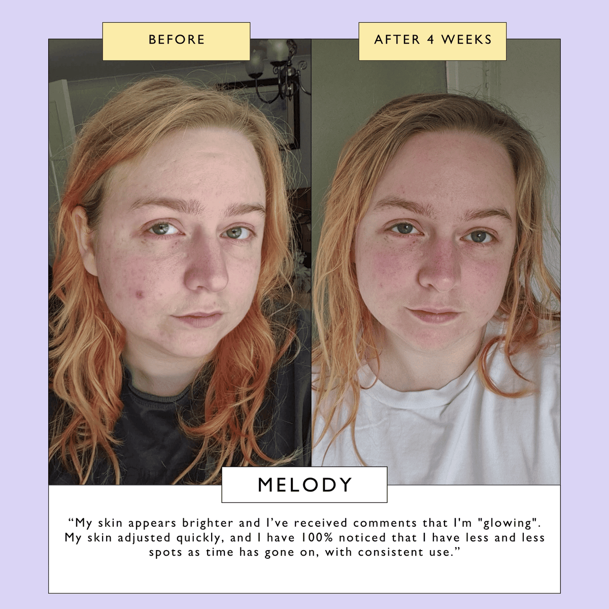 Powder To Foam Face Wash with Willow Bark + Papaya Enzymes — image 9