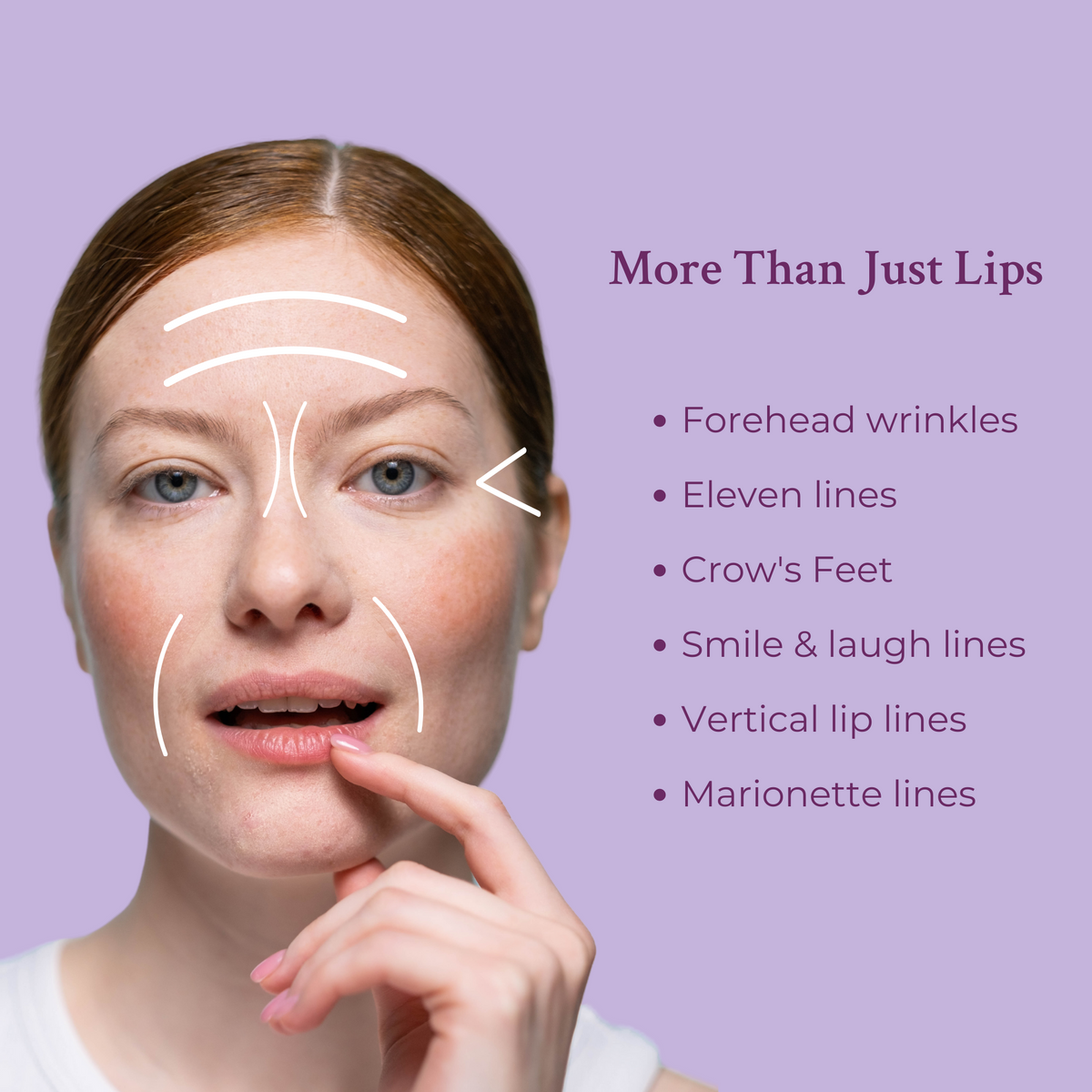 Ageless Lip & Line Filler by PRAI Beauty — image 2 of 6