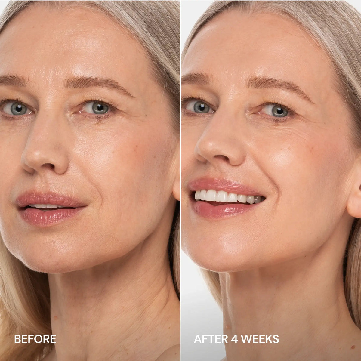 Pro-Retinol Neck Lifting Cream Massager — image 5