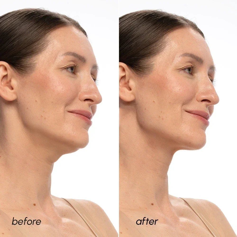 PDRN V-line Lifting Mask — image 3