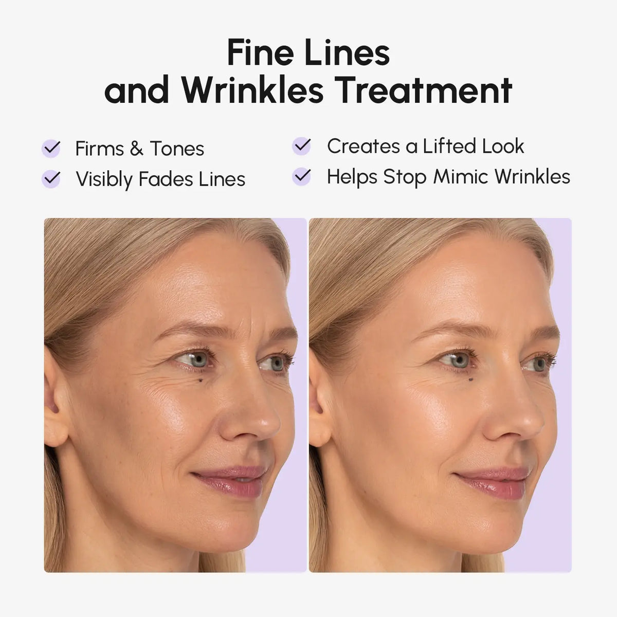 Anti-wrinkle Tape Patches — image 3