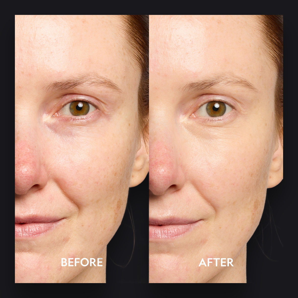 Super Bright Dark Circle Serum Peptide Corrector by YENSA — image 4 of 19