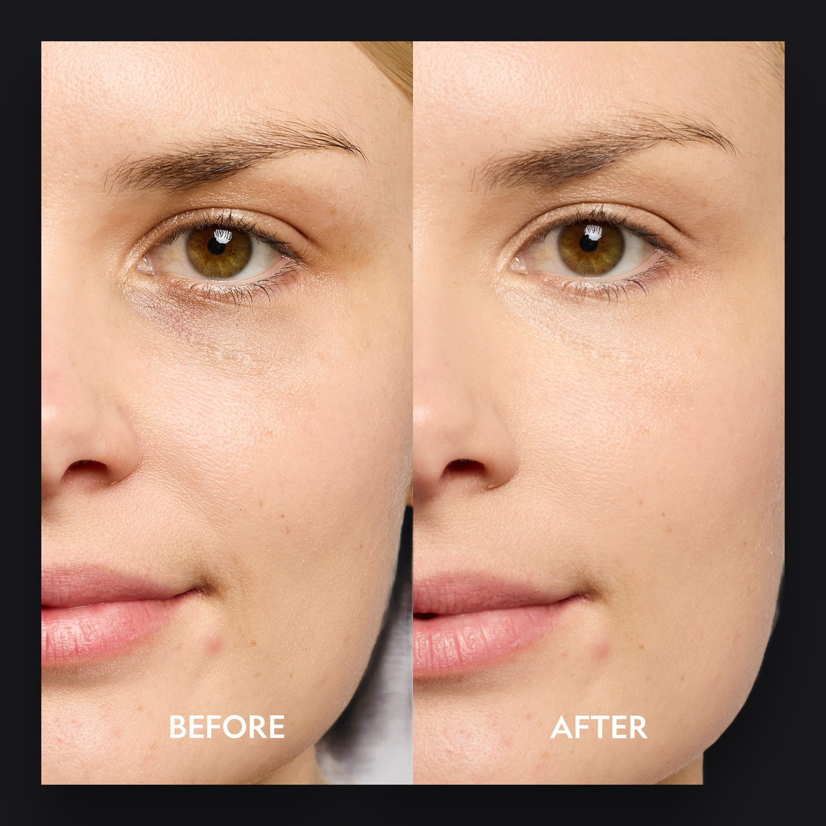 Super Bright Dark Circle Serum Peptide Corrector by YENSA — image 8 of 19
