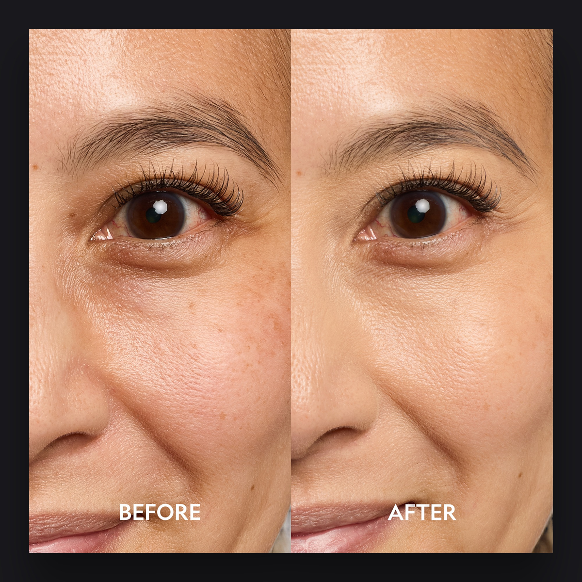 Super Bright Dark Circle Serum Peptide Corrector by YENSA — image 12 of 19