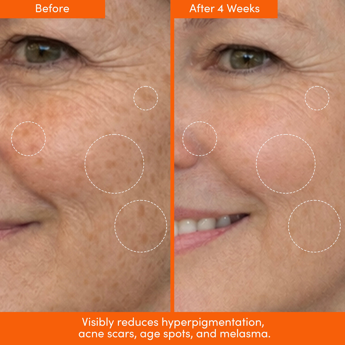 THE PLACENTA FACIAL Dark Spot Serum + Barrier Repair Cream Bundle — image 7