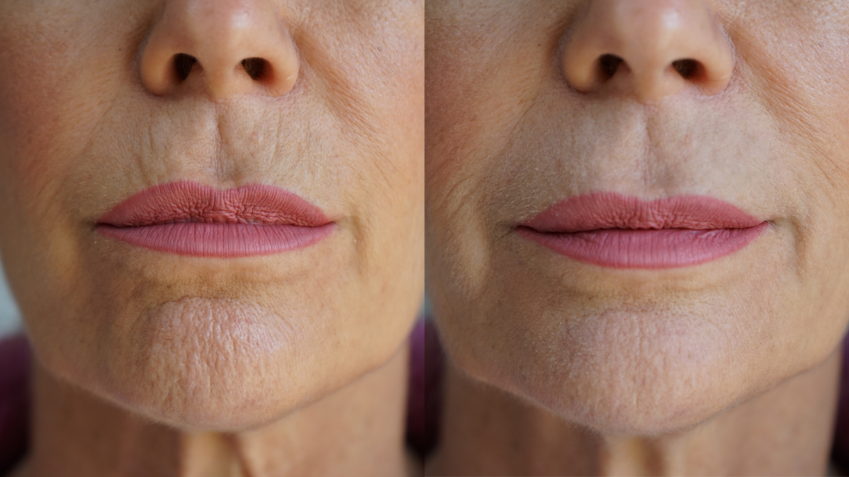 Ageless Lip & Line Filler by PRAI Beauty — image 6 of 6
