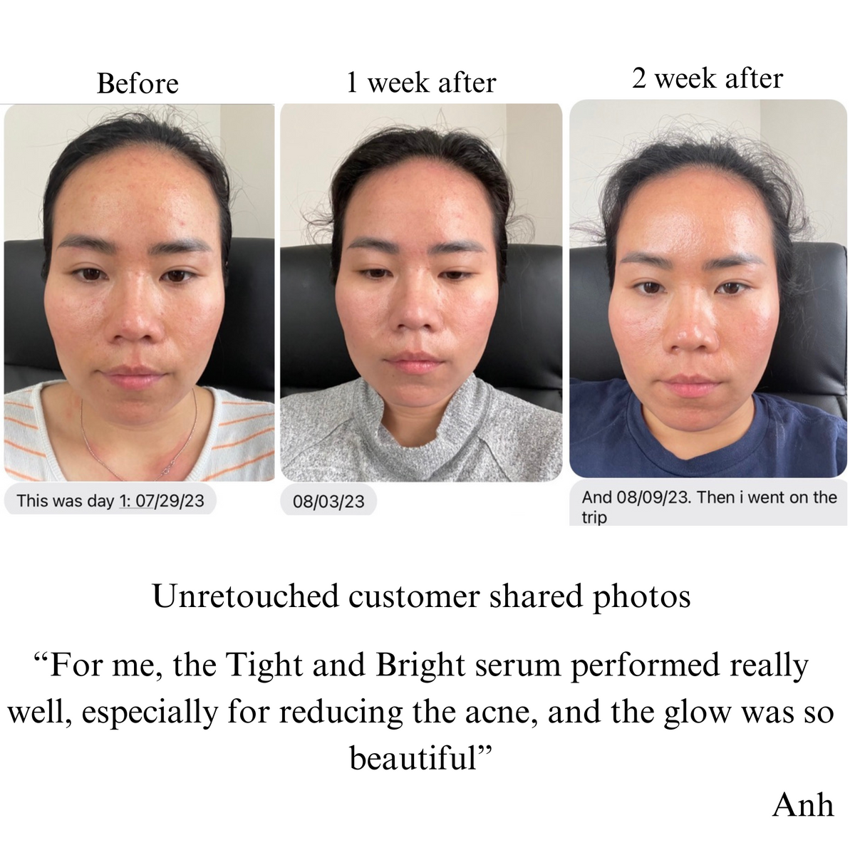 TIGHT AND BRIGHT, an Advanced Gentle Phyto-Retinol and Vitamin C Face Serum, 12 Innovative Technologies, 55% High-Performance Cosmeceuticals — image 8