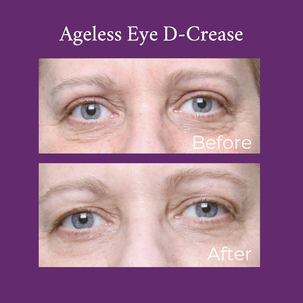 Ageless Eye D-Crease by PRAI Beauty — image 3 of 3