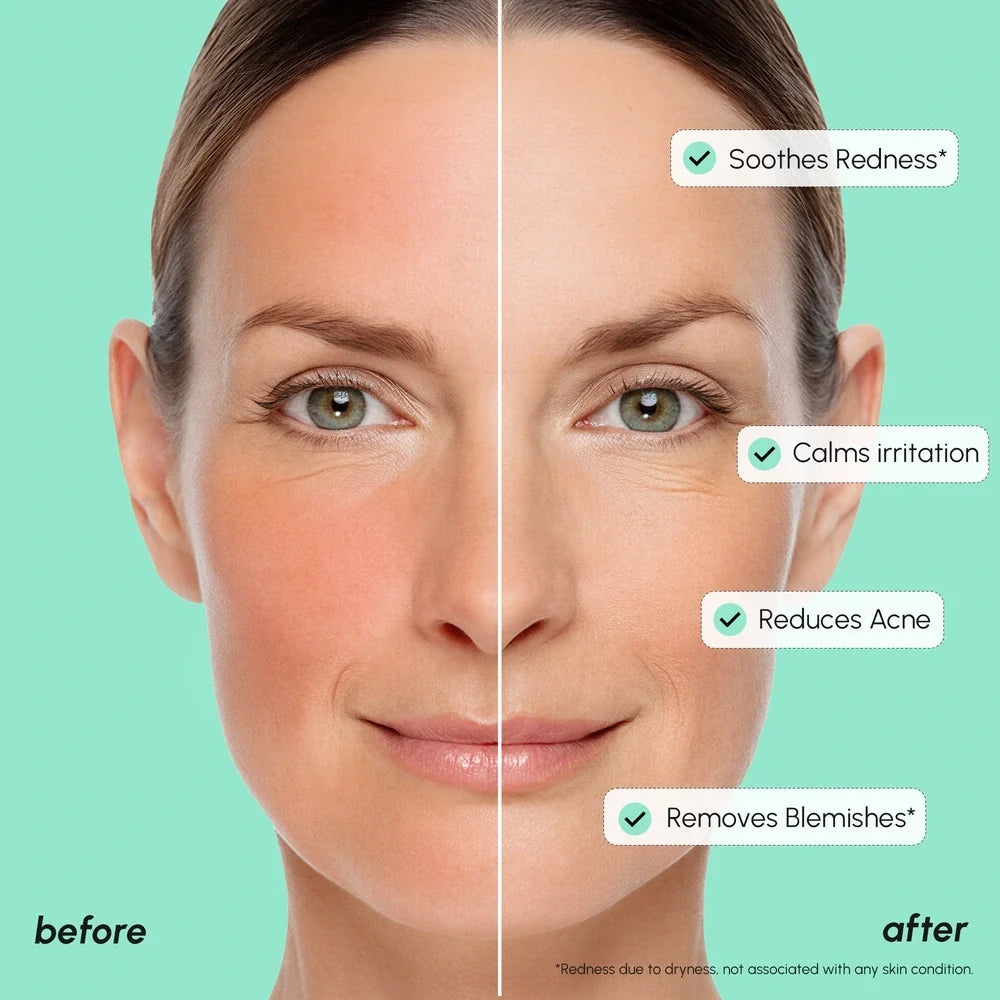 Redness Soothing Azelaic Acid Serum — image 4