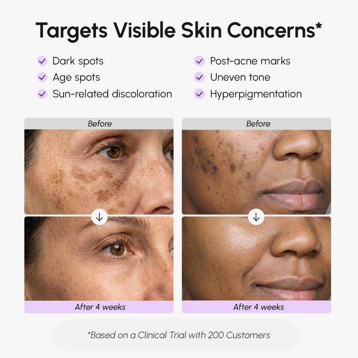 Face & Body Serum for Dark Spots — image 3