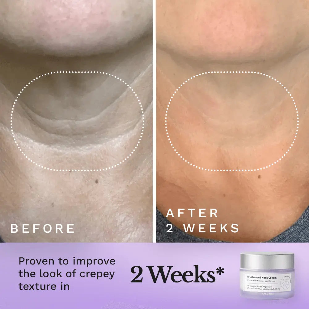 NF Advanced Neck Cream — image 3