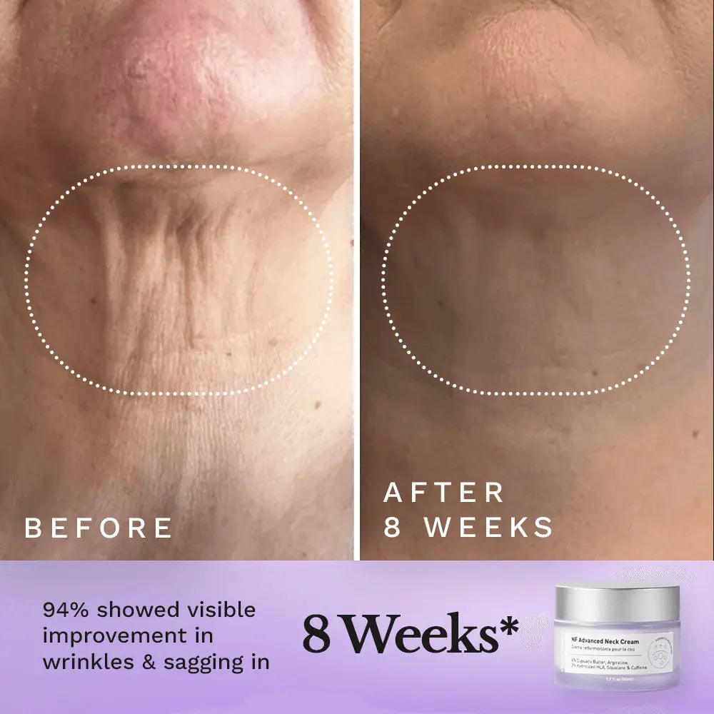 NF Advanced Neck Cream — image 4