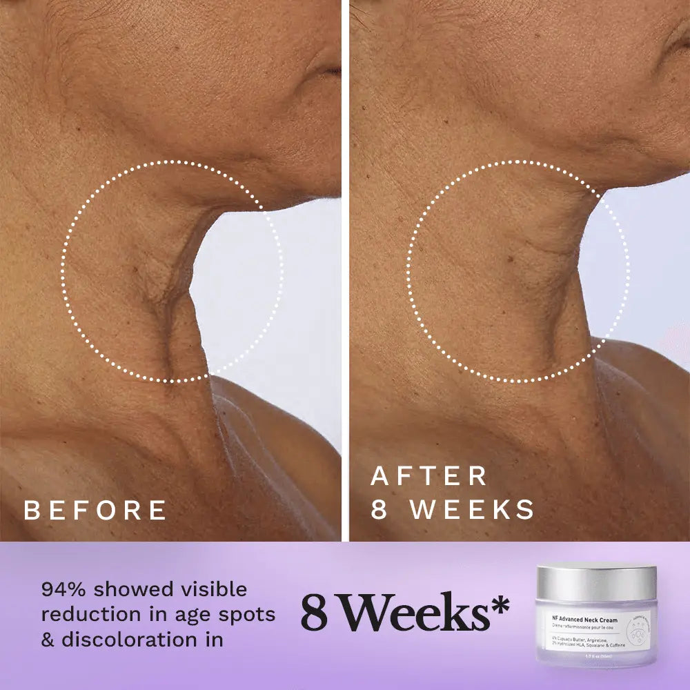 NF Advanced Neck Cream — image 5