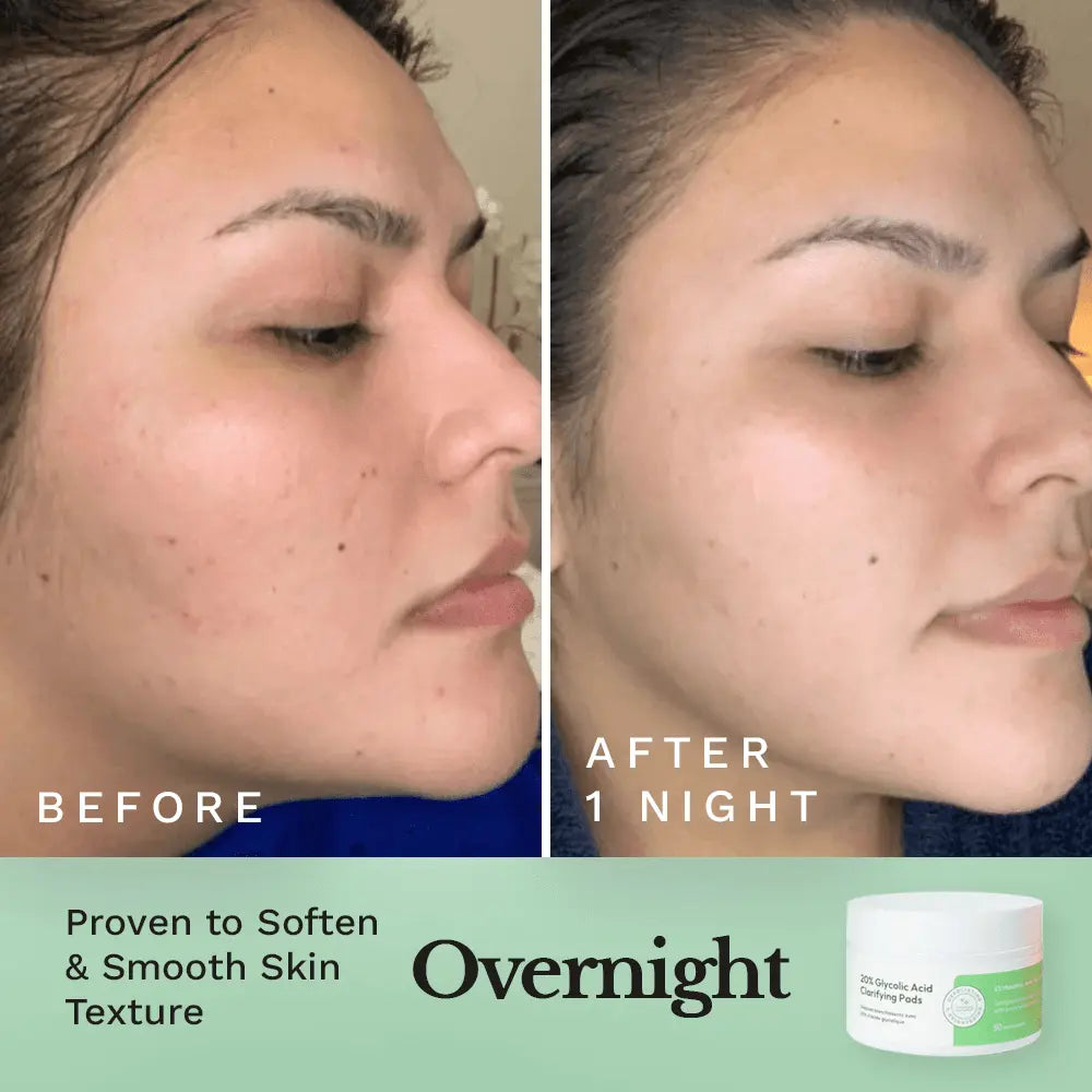 Glycolic Resurfacing Peel Pads — image 3