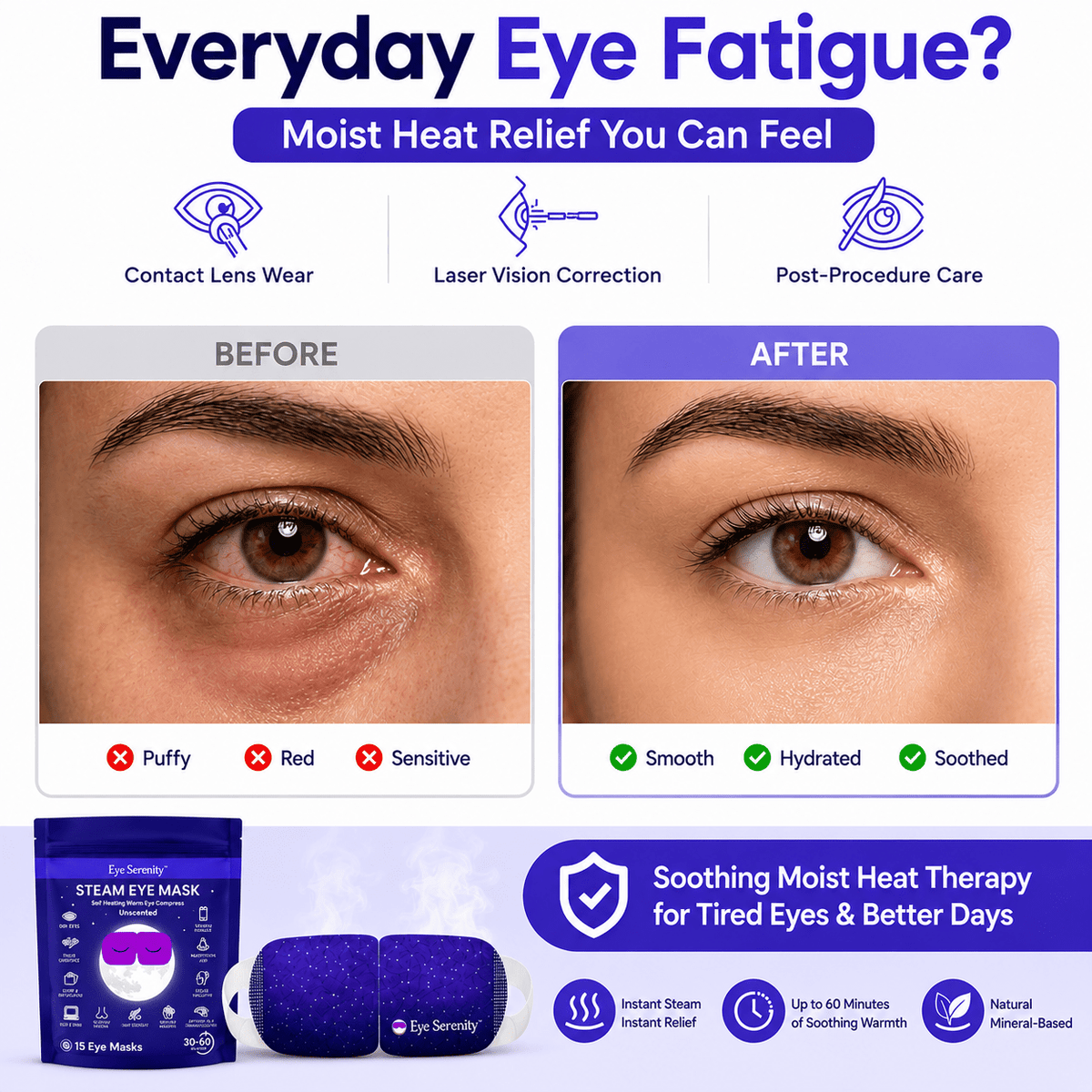 Eye Serenity Steam Eye Mask - Self-Heating Warm Eye Compress for Dry Eyes, Puffiness, Sleep & Travel — image 3