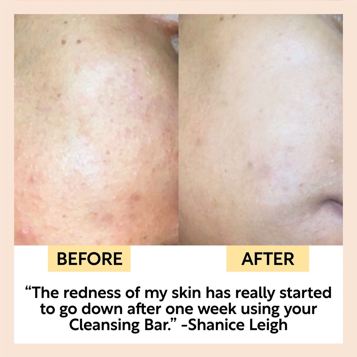 Chai Soap Cleansing Duo — image 9