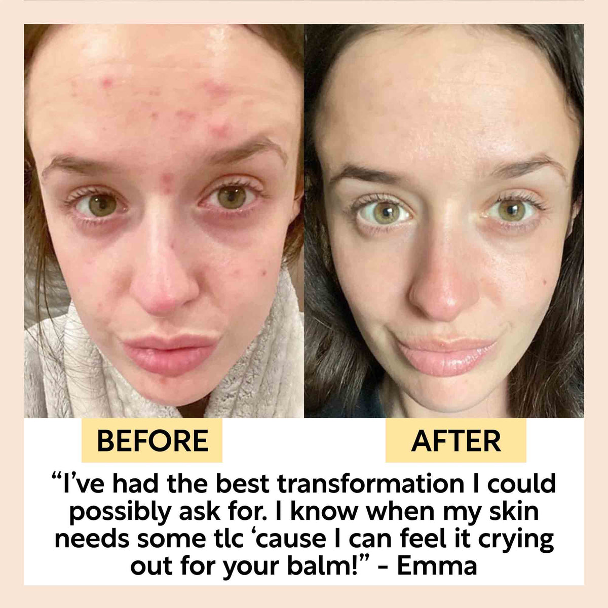 Cleansing Face Balm with Oat Oil + Vitamin E — image 10