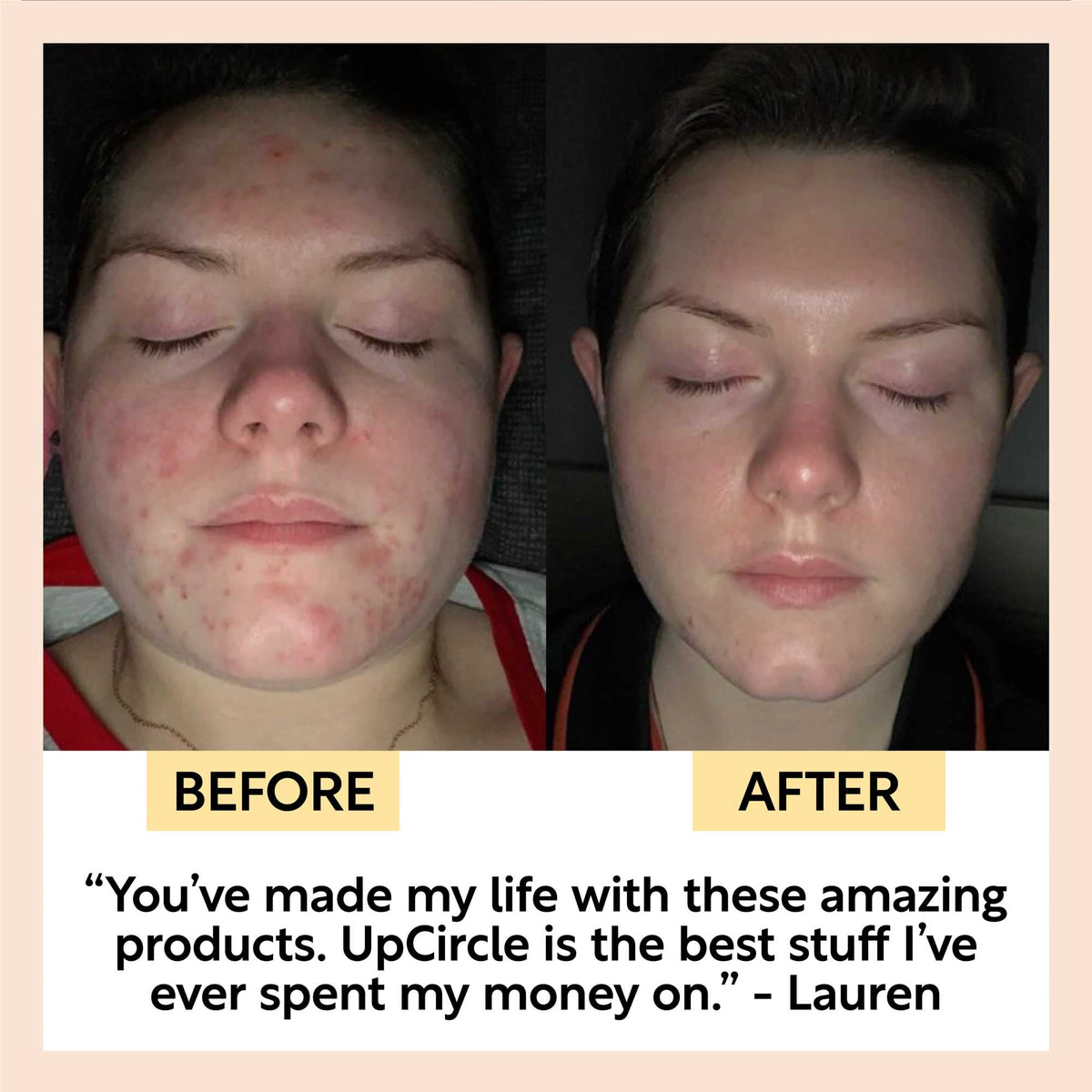 Cleanse, Tone + Moisturize Set — image 7