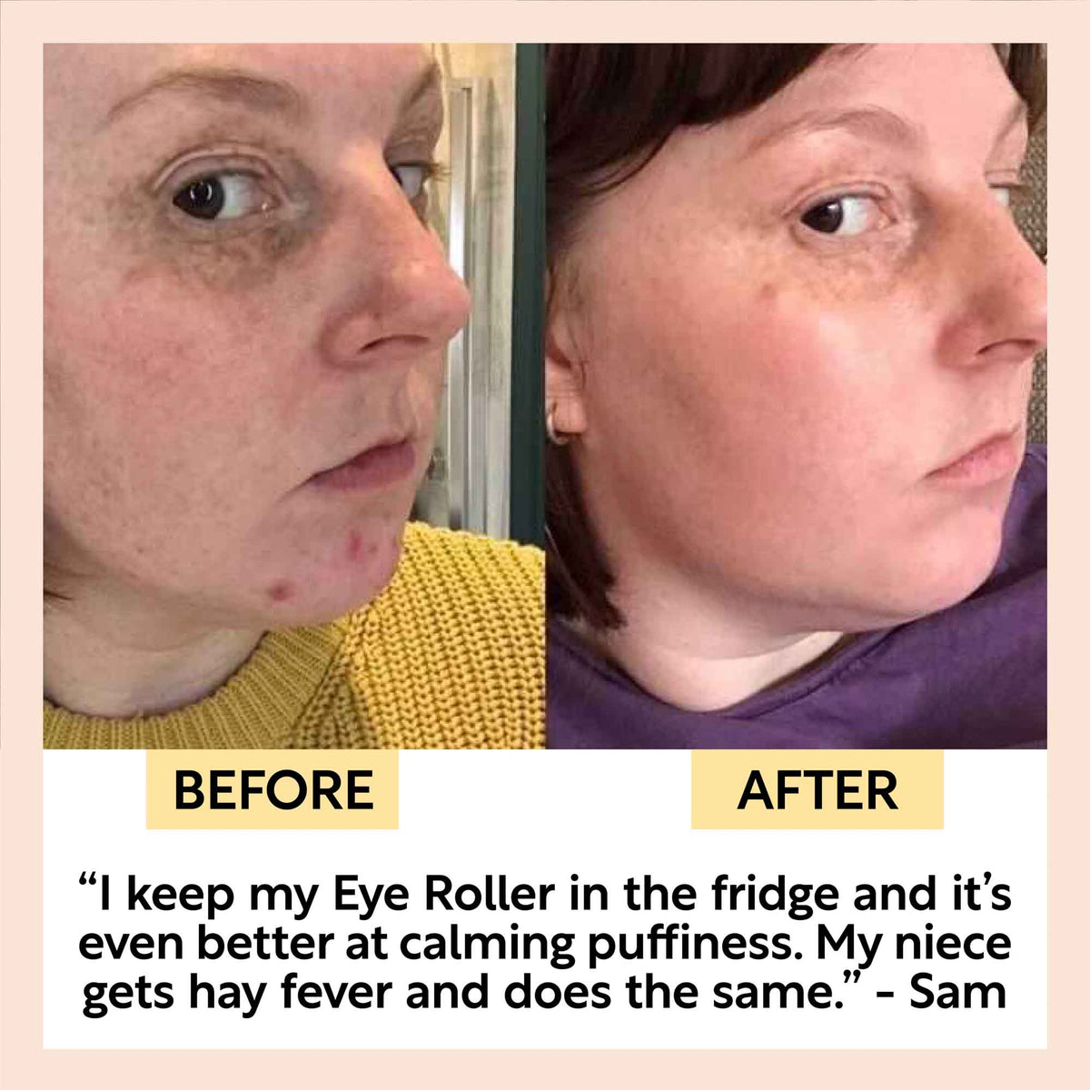 Soothing Eye Roller — image 6