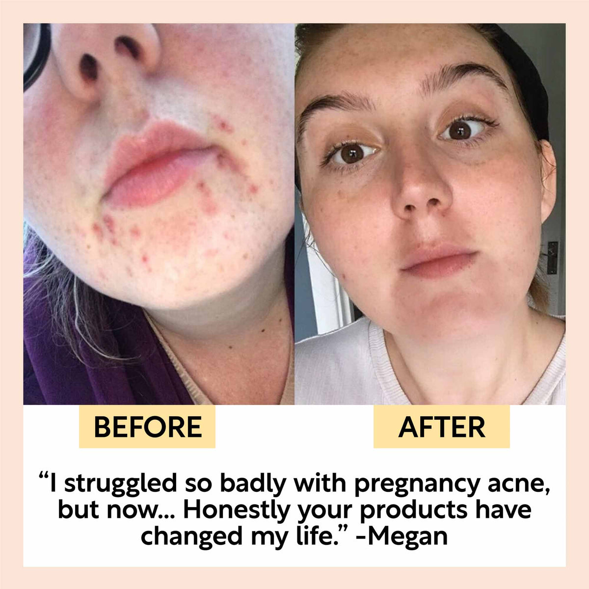 Cleanse, Tone + Moisturize Set — image 8