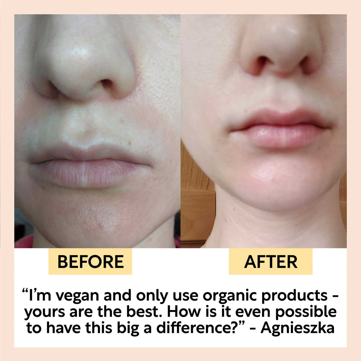 Hydration Skincare Set — image 7