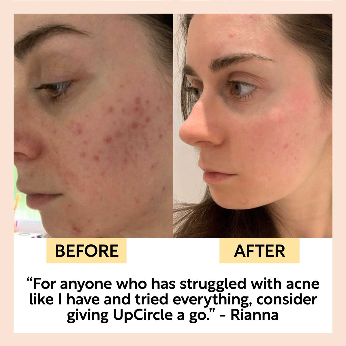 Cleanse, Tone + Moisturize Set — image 9
