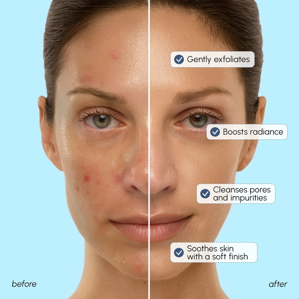 Face Polishing Scrub & Exfoliator — image 3