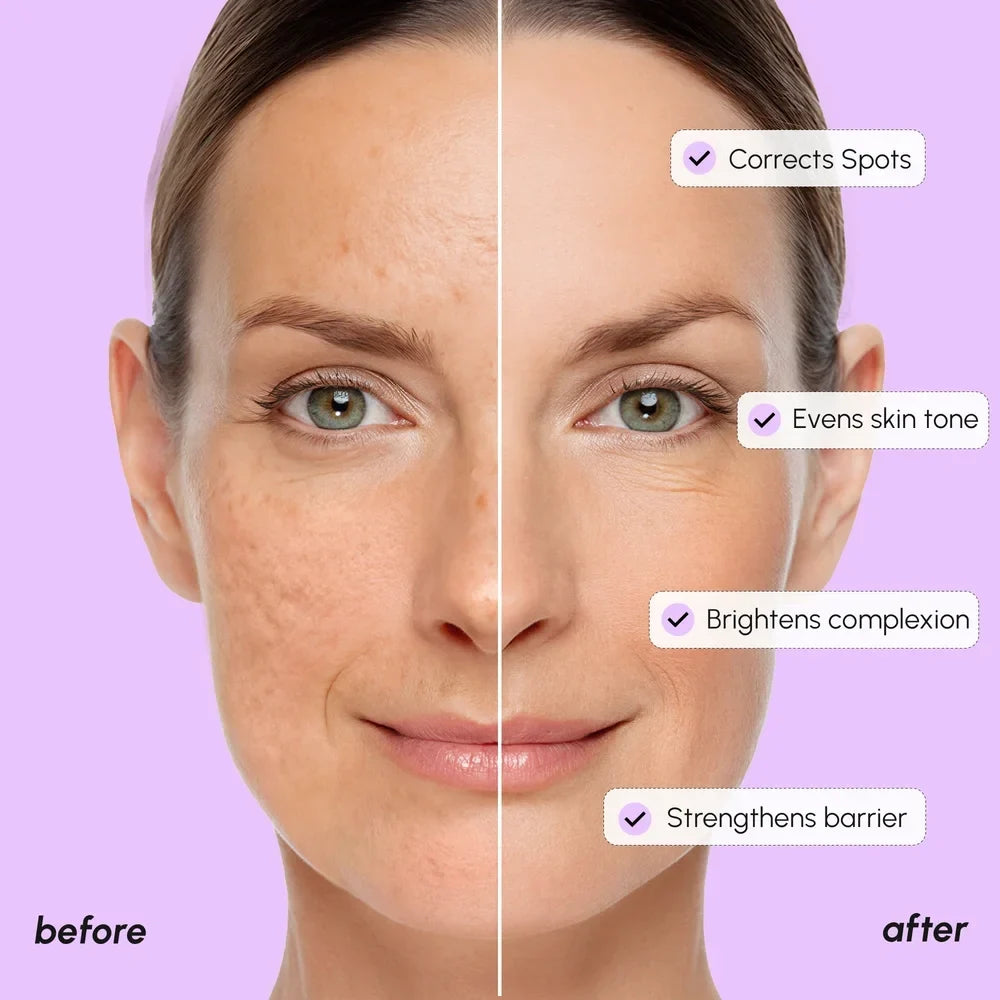 Dark Spot Corrector — image 4
