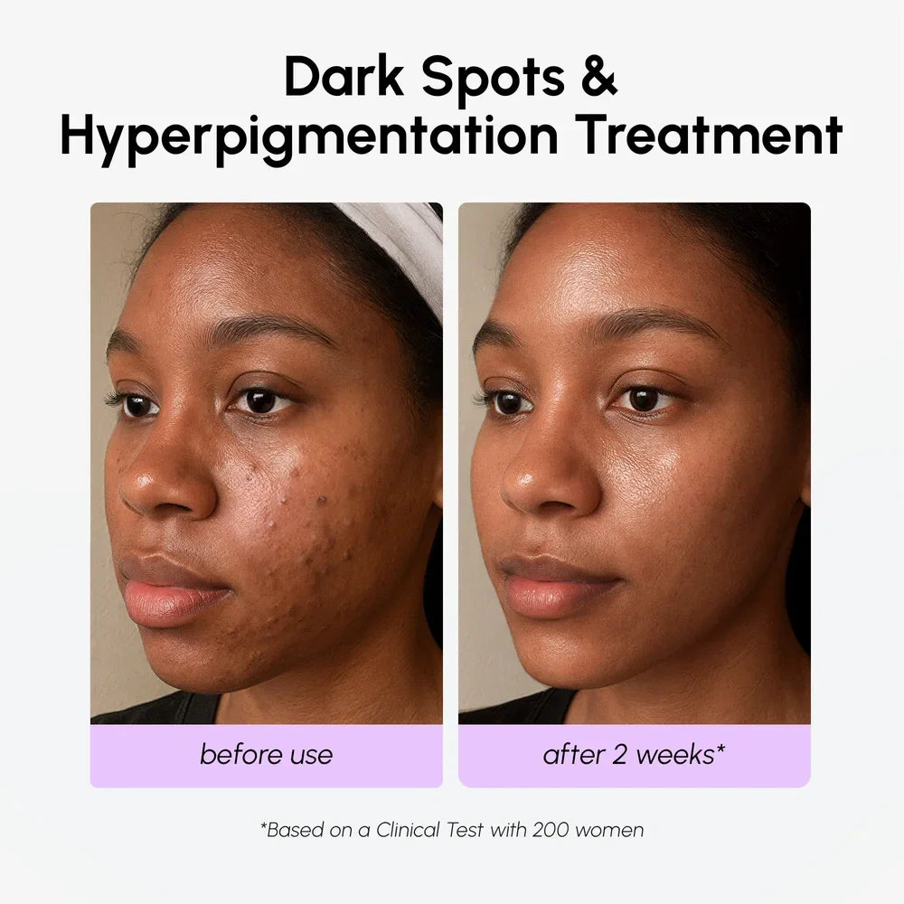 Dark Spot Corrector — image 5