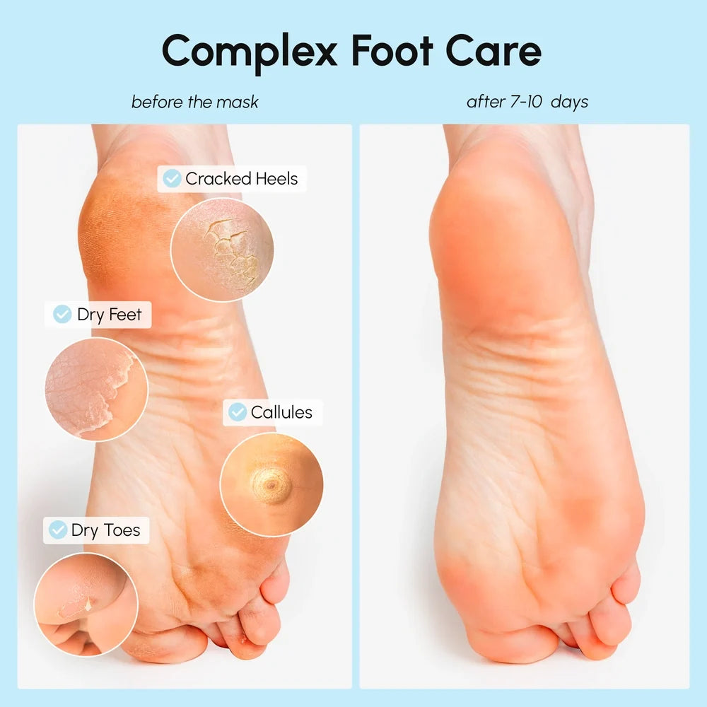 Exfoliating & Hydrating Foot Mask — image 3
