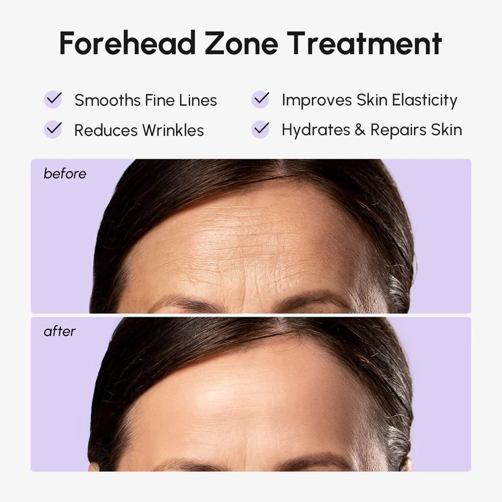 Anti-Wrinkle Forehead Patches — image 3