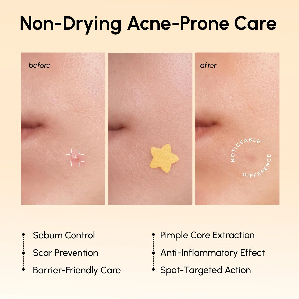 Gold Star Pimple & Acne Patches — image 3