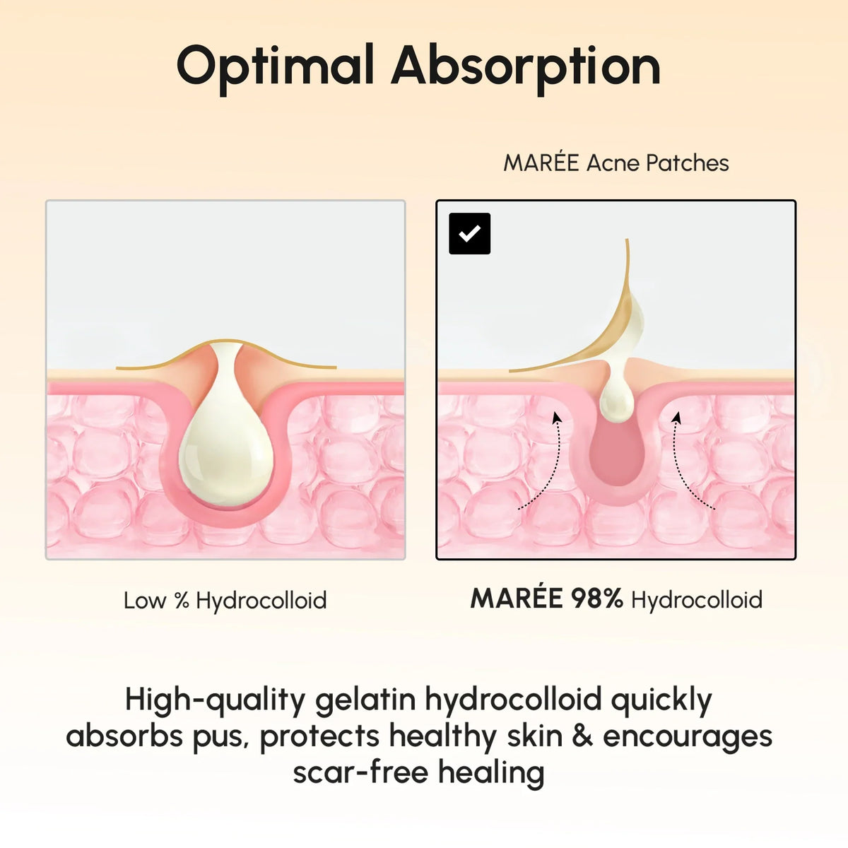 Gold Star Pimple & Acne Patches — image 8