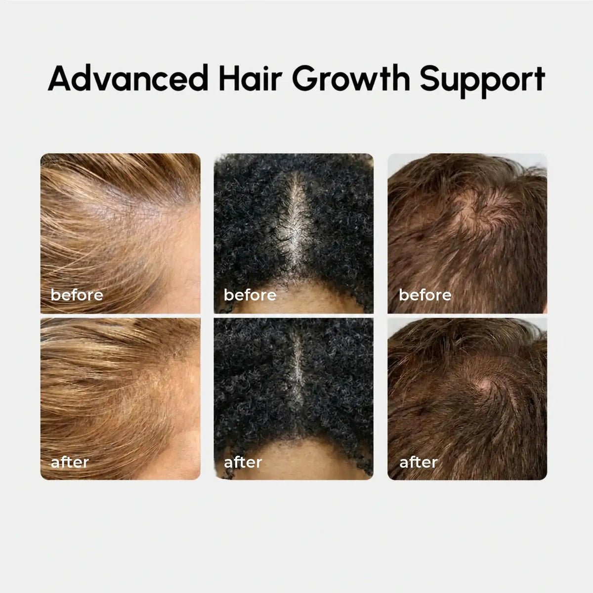 4-in-1 Hair Growth Spray — image 3