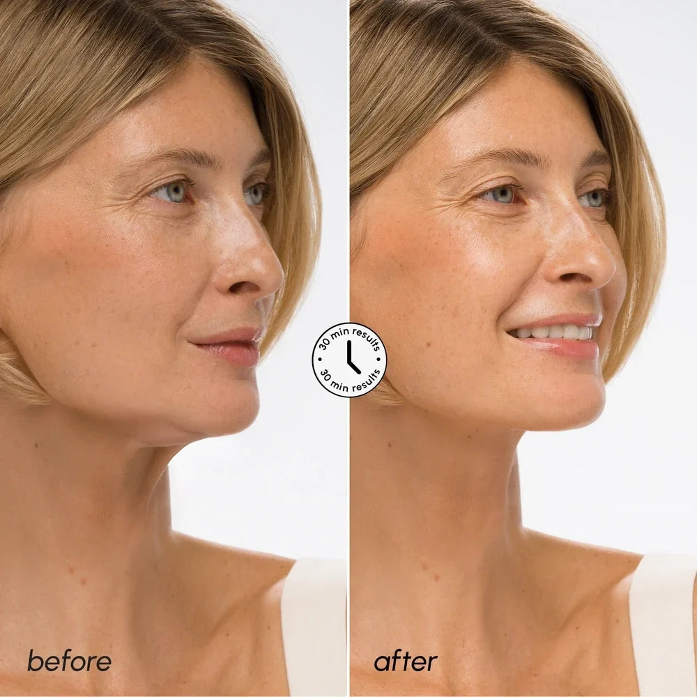 Hyaluronic Acid V-line Lifting Mask — image 3