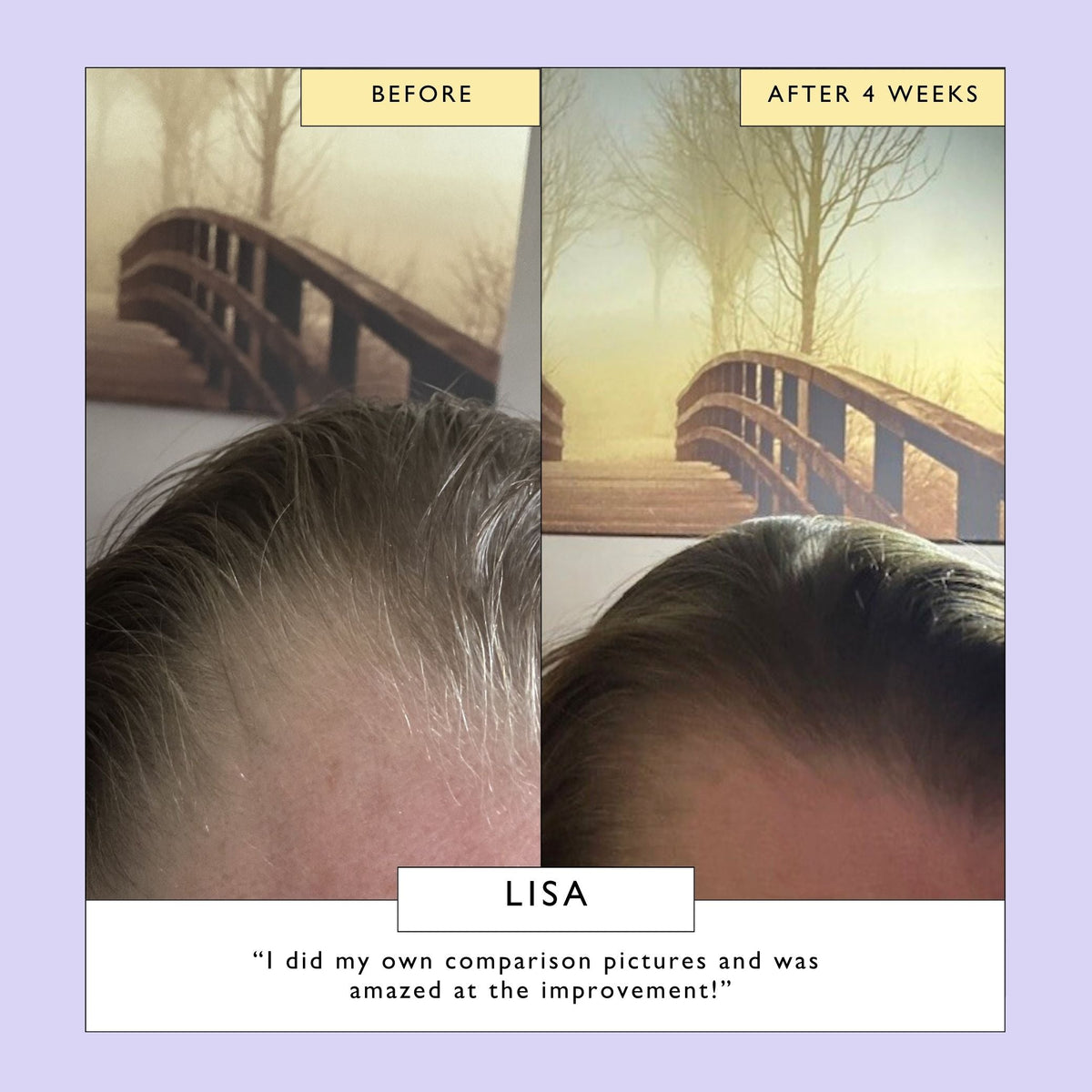 Scalp + Hair Oil with Bacuri Butter + Castor Oil — image 4